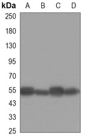 Beta-tubulin Mouse Monoclonal Antibody