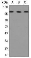 Hexokinase 2 Mouse Monoclonal Antibody