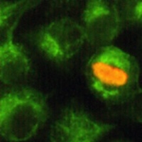 SIRT2 Mouse Monoclonal Antibody