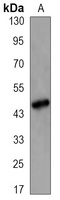 CD95 Antibody