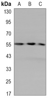Cytokeratin 7 Mouse Monoclonal Antibody