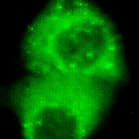 Cytokeratin 7 Mouse Monoclonal Antibody