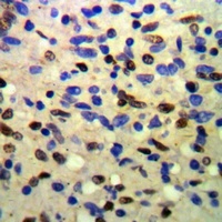 TIF1 beta Mouse Monoclonal Antibody