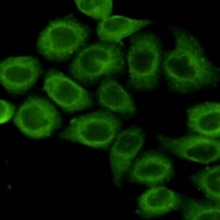 PDHA1 Mouse Monoclonal Antibody