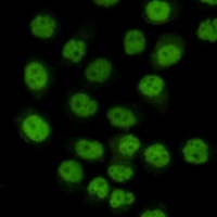SMC1A Mouse Monoclonal Antibody
