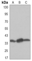 PP1 alpha Mouse Monoclonal Antibody