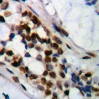 PRMT6 Mouse Monoclonal Antibody