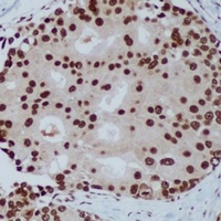 HP1 alpha Mouse Monoclonal Antibody