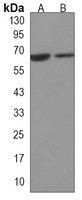 JMJD6 Mouse Monoclonal Antibody
