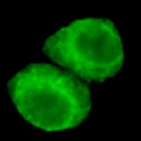 JMJD6 Mouse Monoclonal Antibody