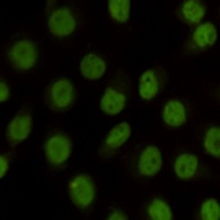 KDM1A Mouse Monoclonal Antibody
