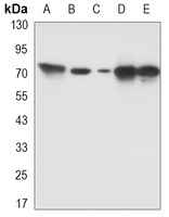 PKC beta Rabbit Monoclonal Antibody
