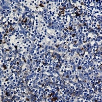 PKC beta Rabbit Monoclonal Antibody