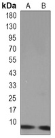 UBB Rabbit Monoclonal Antibody