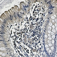 UBB Rabbit Monoclonal Antibody