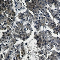TORC2 Rabbit Monoclonal Antibody