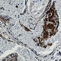 Thrombospondin 1 Rabbit Monoclonal Antibody