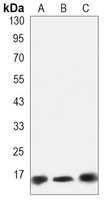 SOD1 Rabbit Monoclonal Antibody