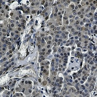 STAT5B Rabbit Monoclonal Antibody