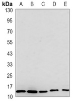 RPS20 Rabbit Monoclonal Antibody