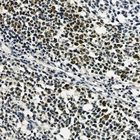 RPS20 Rabbit Monoclonal Antibody