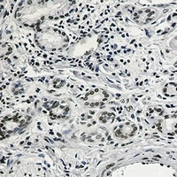 RAD21 Rabbit Monoclonal Antibody