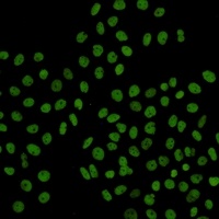 RAD21 Rabbit Monoclonal Antibody