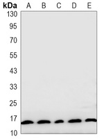 LC3-I/II Rabbit Monoclonal Antibody