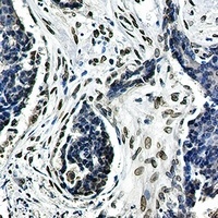Lamin A/C Antibody