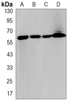 KEAP1 Rabbit Monoclonal Antibody