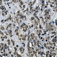 KEAP1 Rabbit Monoclonal Antibody