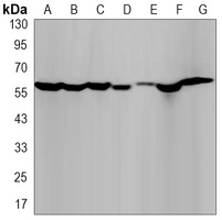 IMPDH2 Rabbit Monoclonal Antibody