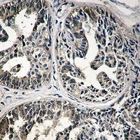 IMPDH2 Rabbit Monoclonal Antibody