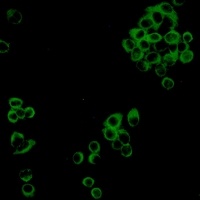 IMPDH2 Rabbit Monoclonal Antibody