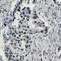 HIF1 beta Rabbit Monoclonal Antibody