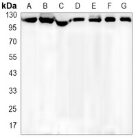 EG5 Rabbit Monoclonal Antibody