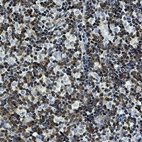DGK alpha Rabbit Monoclonal Antibody