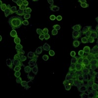 Collagen 1 alpha 1 Rabbit Monoclonal Antibody