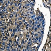 Cofilin Rabbit Monoclonal Antibody