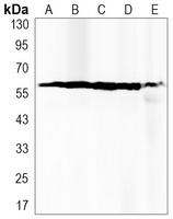 PPP3CA Rabbit Monoclonal Antibody