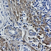 Filamin A/B (Phospho-S2152/2107) Rabbit Monoclonal Antibody