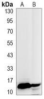 Histone H3 (TriMethyl-K27) Antibody