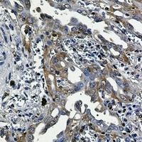 RSK3 Rabbit Monoclonal Antibody