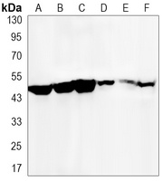 KIM1 Rabbit Monoclonal Antibody