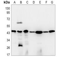 CD142 Rabbit Monoclonal Antibody