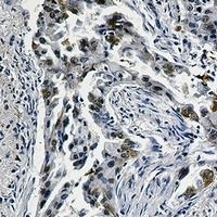 CD142 Rabbit Monoclonal Antibody