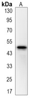 Wnt-5a Rabbit Monoclonal Antibody