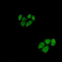 Wnt-5a Rabbit Monoclonal Antibody