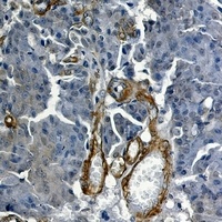 Vinculin Rabbit Monoclonal Antibody
