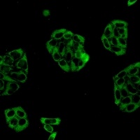 Vinculin Rabbit Monoclonal Antibody